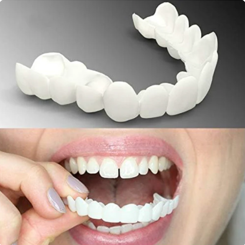 SOURIRE PARFAIT - FACETTES DENTAIRES INFÉRIEURES ET SUPÉRIEURES